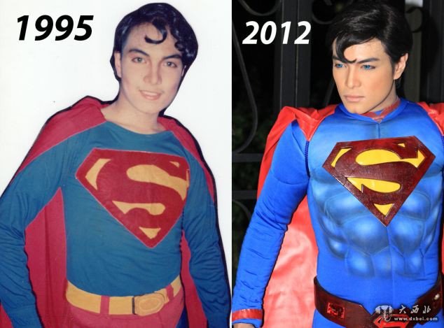 菲律宾男子16年整容19次变“超人”